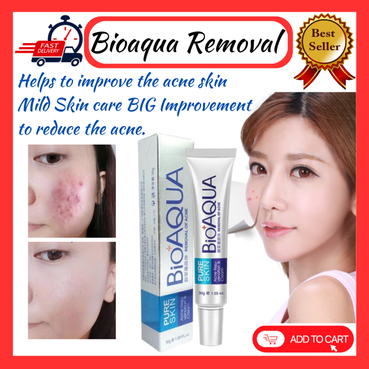 (BIOAQUA ACNE) BEST ACNE & PIMPLES REMOVAL CREAM, Acne Scar Mark ...