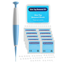 Auto Band Non Toxic Face Care Mole Wart Tool For Small To Medium Blue Skin Tag Removal Kit With Cleansing Swabs Home Use