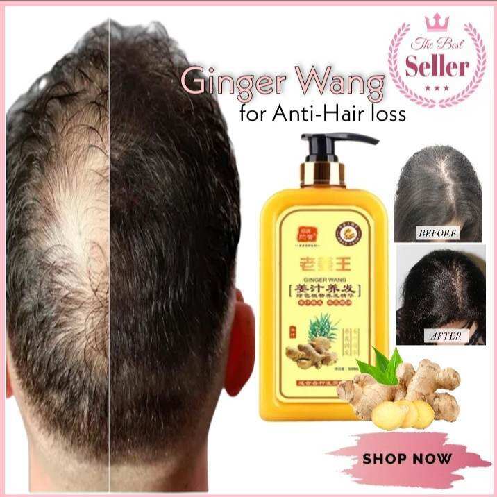 100 Original Natural Ginger Shampoo For Hair Loss Herbal Ginger Extract Shampoo Hair Grower For 8246