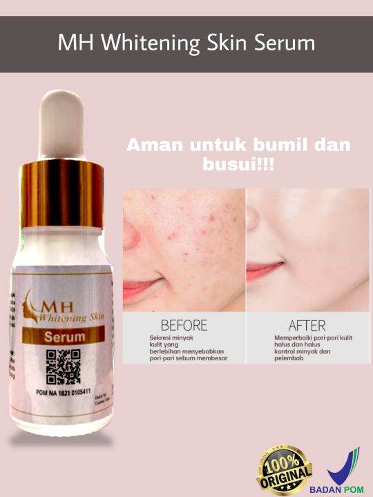 Mh Skincare Untuk Flek Hitam