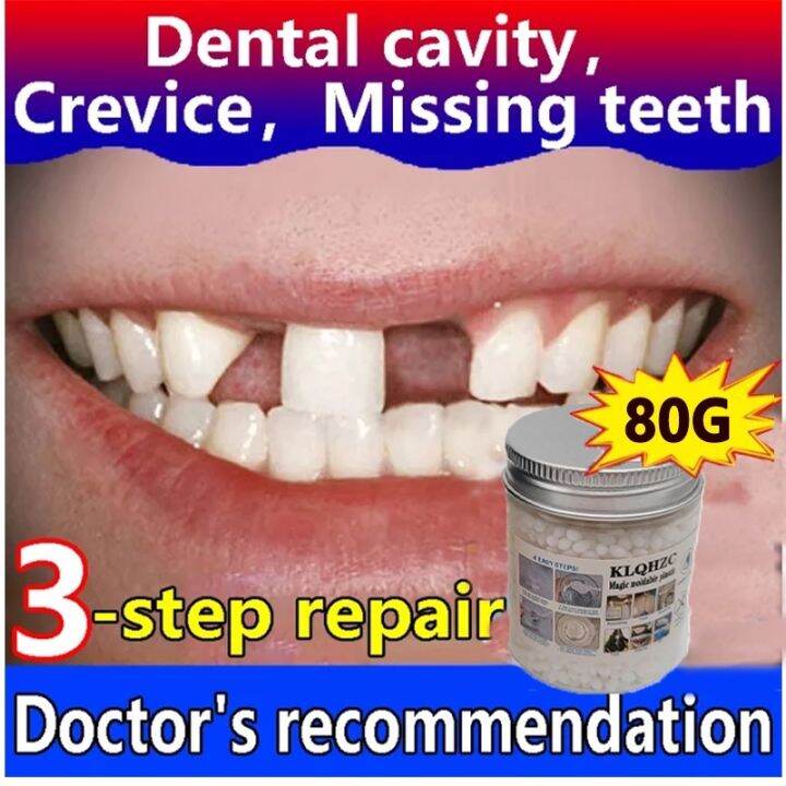 【80g Pack 】 Temporary Tooth Repair Kit Tooth and Gap Plastic Denture