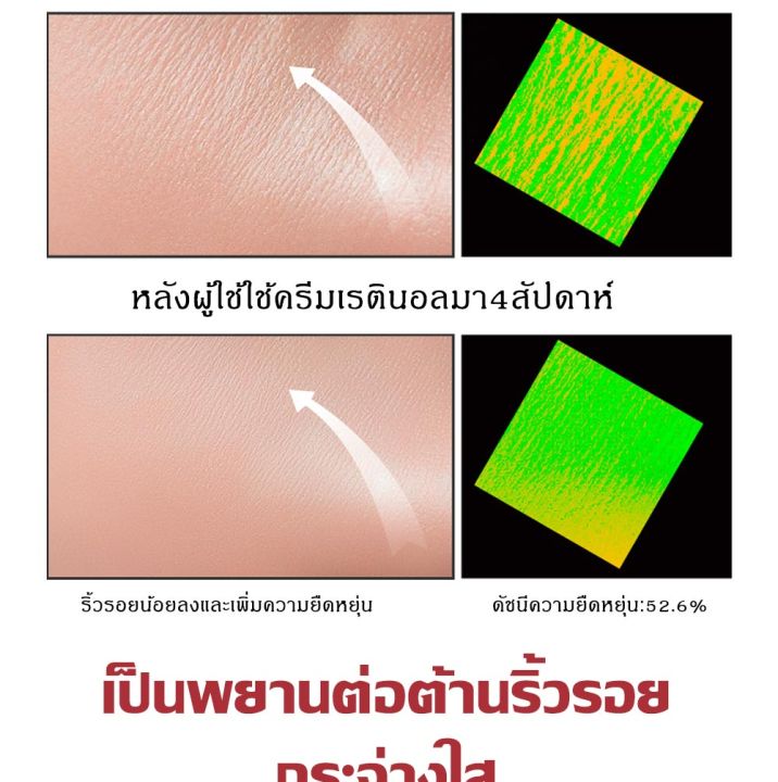 ครีมลดถุงใต้ตา-ครีมทาถุงใต้ตา-ครีมลบถุงใต้ตา-ครีมทาใต้ตาดำ-retinol-eye-cream-อายครีมเรตินอล-กระชับ-ยกกระชับ-อายครีมลดริ้วรอย-ลดบวมถุงใต้ตา-ขอบตาดำ-และอนุภาคไขมัน