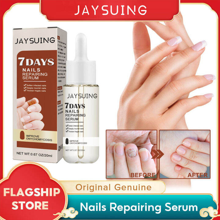 Jaysuing 7 Days Nails Repair Serum Treatments Essence Toe Nails Fungal