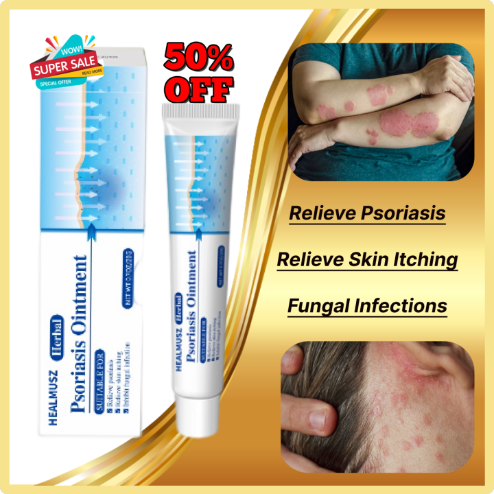 Psoriasis Ointment herbal Antibacterial for skin psoriasis cream