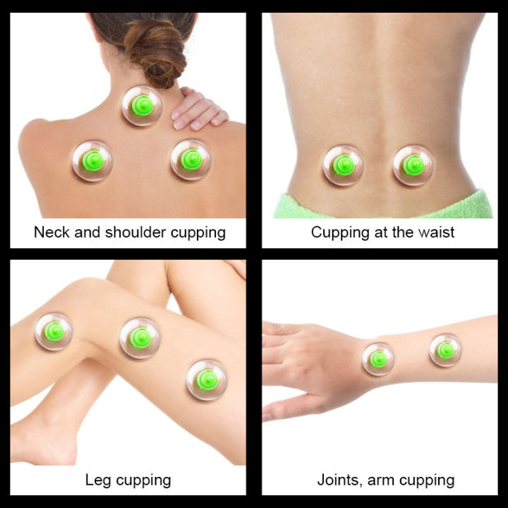 6pcs-จีน-gua-sha-jar-สูญญากาศ-cupping-กระป๋อง-cellulite-ดูดถ้วยดูด-body-tpy-นวด-anti-cellulite-กระป๋อง-health