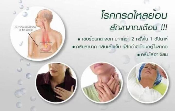 แกสตรา-เฮิร์บ-แกสตราเฮิร์บกิฟฟารีน-แบบแคปซูล-สมุนไพรเย็น-7-ชนิด-กรดไหลย้อน-แสบร้อนทรวงอก-60-แคปซูล