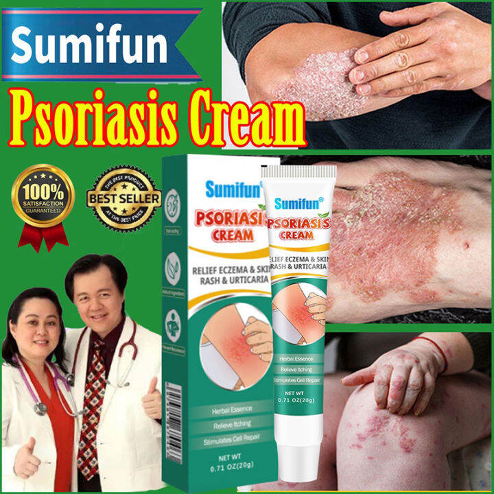 Sumifun Psoriasis Dermatitis Eczema Treatment Cream Antibacterial ...