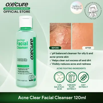 Shop Oxecure Acne Facial Cleanser 120ml with great discounts and