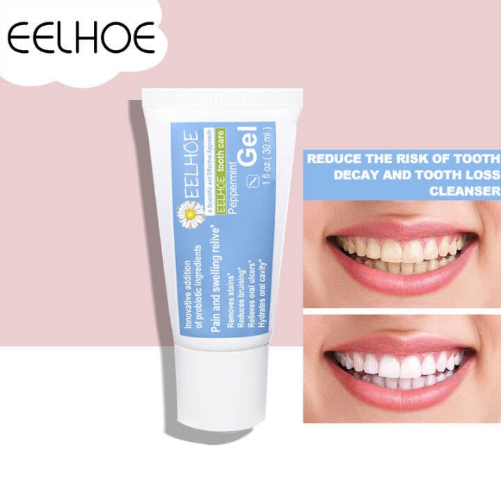 Eelhoe Probiotic Tooth Gel Whitening Tooth Removal Odor Anti ...