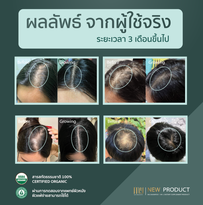 แชมพู-ผมร่วง-ผมบาง-กำจัดรังแค-m2-แบรนด์-my-organic-set-แชมพู-ครีมนวด