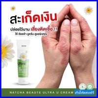 ของแท้ 100% Natcha Ultra U นัชชา อัลตร้ายู ครีม ลดปัญหาผิว (30 g) เก็บโค๊ดส่งฟรี