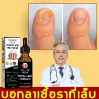 【บอกลาโรคเชื้อราที่เล็บ!】เซรั่มเล็บขบ ซ่อมแซมเล็บเสีย ส่งเสริมการเจริญเติบโตของเล็บดีเยี่ยม ยากันเชื่อราเล็บ（เซรั่มเล็บ ยารักษาเล็บ ยารักษาเล็บรา ยารักษาเล็บมือ ยารักษาเล็บคบ เชื้อราที่เล็บ ยารักษาเชื้อราที่เล็บ เซรั่ม น้ำมันทาเล็บ เซรั่มทาเล็บเสีย）