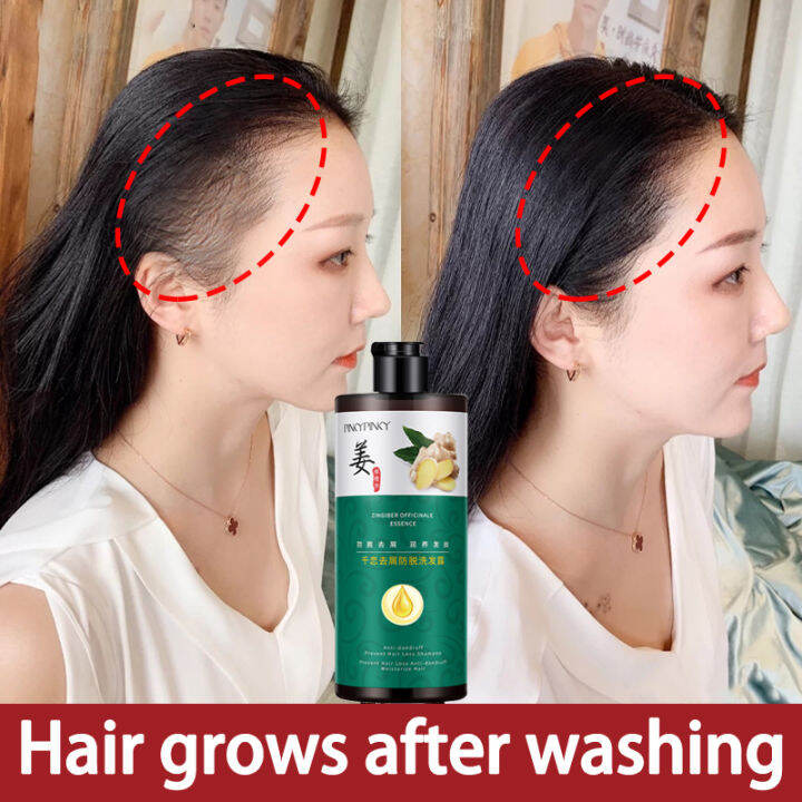 Korea Amazing Collagen Scalp Shampoo - Improve Hair Fall, Dandruff Conditioner Hair Oil Hair Tonic Hair Treatment Ginger shampoo prevents hair loss hair increase dense growth hair shampoo anti-dandruff oil control Hair Korea Amazing Collagen Scalp Shampoo - Improve Hair Fall, Dandruff Conditioner Hair Oil Hair Tonic Hair Treatment Ginger shampoo prevents hair loss hair increase dense growth hair shampoo anti-dandruff oil control Hair