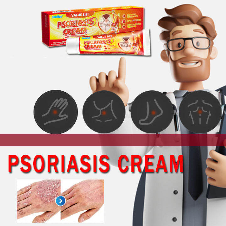 Psoriasis treatment cream eczema erythema itchy hands feet scalp skin