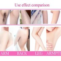 ZZOOI Permanent Hair Removal Cream Hair Growth Inhibitor Painless Armpit Legs Arms Hair Remover Men Women Smooth Repair Body Care 100g