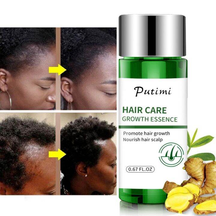 【cw】 20ML Fast Hair Growth Oil Hair Regrowth Essential Oils Hair