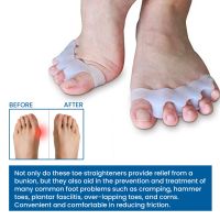 ✧✗ 1 Pair Silicone Toe Straightener Feet Bone Thumb Gels Breathable Super Soft Bunion Corrector For Reduce Friction Between Toes