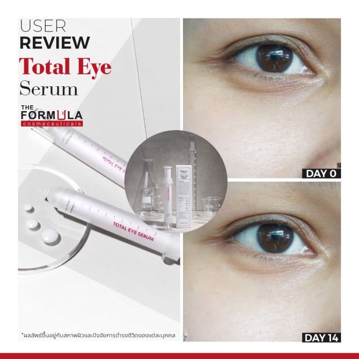 สินค้าขายดีมาก-the-formula-total-eye-serum-10-ml-ครีมทารอบดวงตา-ครีมทาใต้ตา-ลดตาคล้ำถุงใต้ตาและริ้วรอยรอบดวงตา