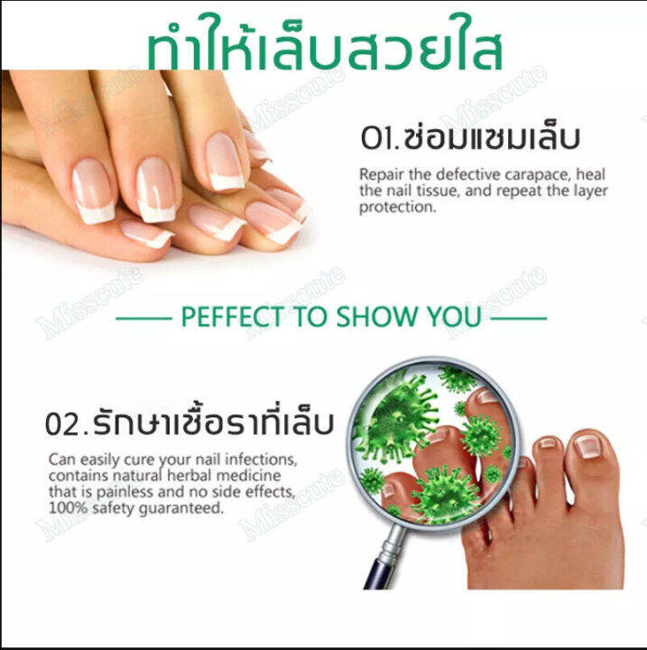 auquest-เชื้อราเล็บมือ-ยาทาแก้เชื้อราที่เล็บ-บำรุงเล็บ-น้ำยารักษาเล็บ-รักษาเล็บเสีย-น้ำยาล้างเล็บ-เซรั่มบำรุงเล็บ-เซรั่มรักษาเล็บ-รักษาเล็บ-ยารักษาเชื้อราที่เล็บ-น้ำมันบำรุงเล็บ-เอ็สเซ้น-ซ่อมแซมเล็บเส