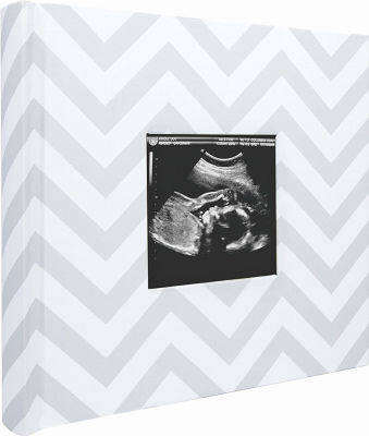 Pearhead Baby Photo Album for Baby Girl or Baby Boy, Gender Neutral Baby Memory Book, Baby Shower, Gray Chevron