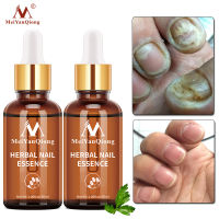 2PCS Treatment Fungal Nail Essence Serum Care Repair Foot Nail Fungus Removal Gel Anti Infection Paronychia Onychomycosis Beauty