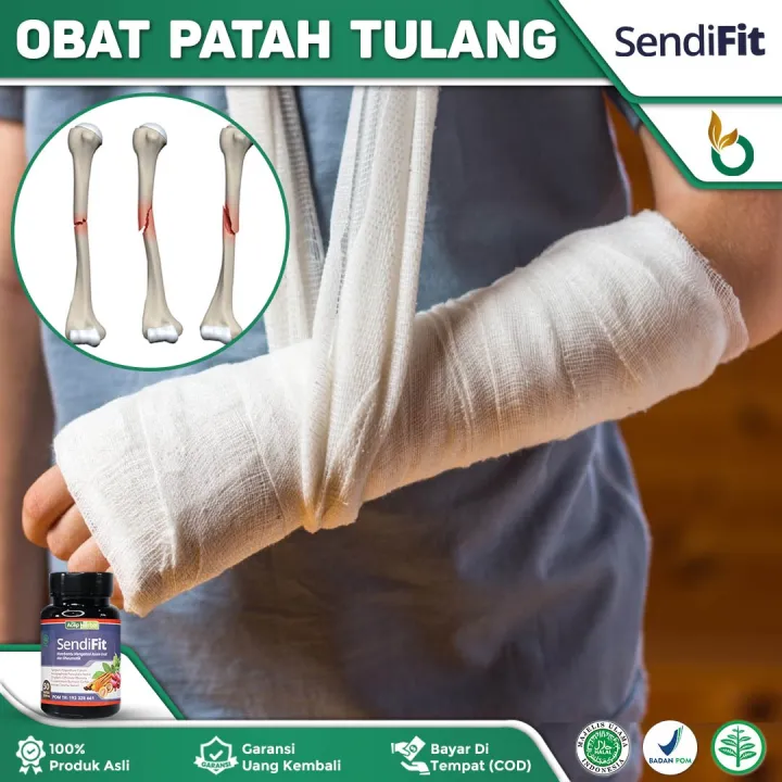 Obat Patah Tulang Akibat Jatuh Kecelakaan Patah Tulang Tangan Patah Tulang Kaki Tulang Patah