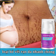 Kem xóa vết rạn da kem sẹo khi mang thai vệt mỡ Đường mỡ nam và nữ Các