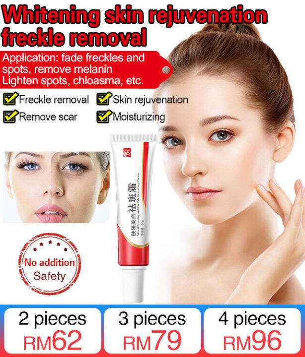 Ttpr niacinamide whitening and freckle removal cream lazada ph