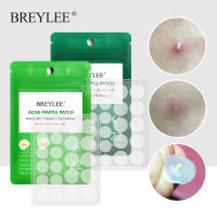 BREYLEE [Stock] 22Patches/Pack Acne Pimple Patch Acne Treatment Stickers Pimple Remover Tool Blemish Spot Skin Care Facial Waterproof Day Night Use Wo