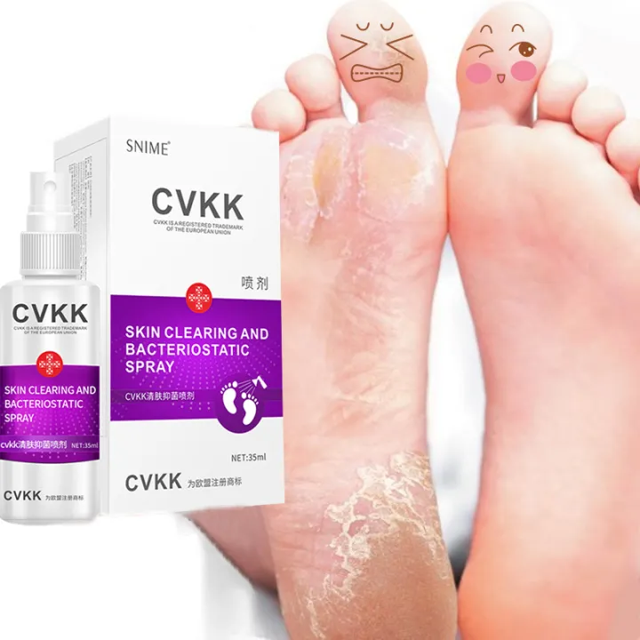 Deodorant Spray Shoes for Women Men Foot Spray Anti Odor Antiperspirant