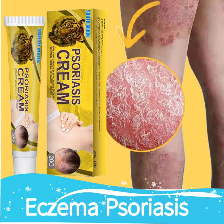 【COD】Psoriasis Cream eksema cream Eczema Herbal Cream Herbal