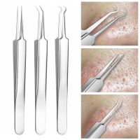 【cw】 1Pc Rvs Meeëter Acne Comedo Blemish Extractor Naalden Pincet Puistje Remover Gereedschap Gezicht Huidverzorging