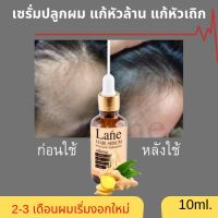 ?สินค้าขายดี?  ยาปลูกผม น้ำยาปลูกผม ปลูกผม น้ำยาใส่ผม น้ำยาปลูกหนวด น้ำยาปลูกคิ้ว แก้ผมร่วง  X1 (ขวด)