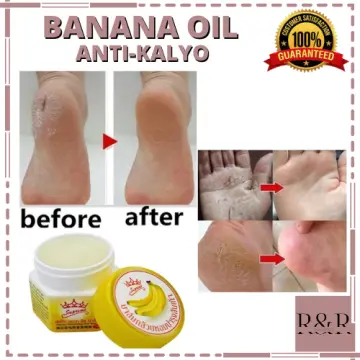 20g foot Dead Skin Remover banana oil Anti-drying crack foot cream cracked  heel repair hand