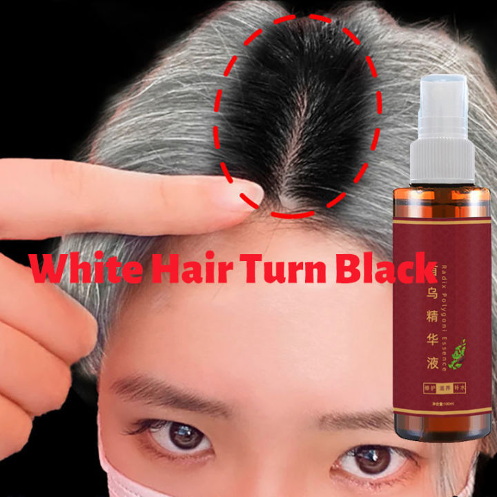 Effective White Hair Turns To Black Hair Gentle Nourshing Hair Roots  Coverage Grey Hair Treatment Care Spray | Lazada