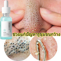 รูขุมขนหดตัวสาระสำคัญ30ml ทำให้ผิวขาวขึ้น เติมเต็มความชุ่มชื้นให้ผิว เซรั่มหน้าใส Firming serum เซรั่มบำรุงผิว รูขุมขนหดตัว ชับใบหน้า