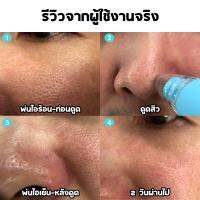 LAVANY เครื่องดูดสิวเสี้ยน สิวหัวดำ พลังดูดสูง พร้อมหัวดูด 3 ชนิด ปรับแรงดูดได้ถึง 3 ระดับ พร้อมระบบสั่นสำหรับสิวหัวดำโยเฉพาะ แถมฟรี!! หัวกรอเพชร 3 หัว และ ถุงผ้ากำมะหยี่อย่างดี