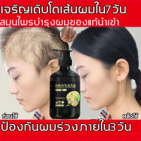 【สินค้านำเข้า】 แชมพูลดผมร่วง  สูตรน้ำขิง ปลูกผมอย่างอ่อนโยน บำรุงรากผม ผมยาวไว ลดผมหลุดร่วง ยับยั้งรังแค สูตรแก้ปัญหา ตรแก้ปัญหาผมร่ว（แชมพูปลูกผม แชมพูแก้ผมร่วง  แชมพูเร่งผมยาว  แชมพูลดผมดก ครีมปลูกผมดก น้ำยาปลูกผม แชมพูขิง​ ）