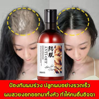 แชมพูเร่งผมยาว ยาสระผมแก้ร่วง Hair loss shampoo ยับยั้งรังแค แชมพูลดผมร่วง แชมพูแก้ผมร่วง ผมบาง ปลูกผม เร่งผมเกิดใหม่ ผมยาวไว ยาสระผมแก้ผมร่วงสูตรแก้ปัญหาผมร่วง แชมพูขิงเพียว