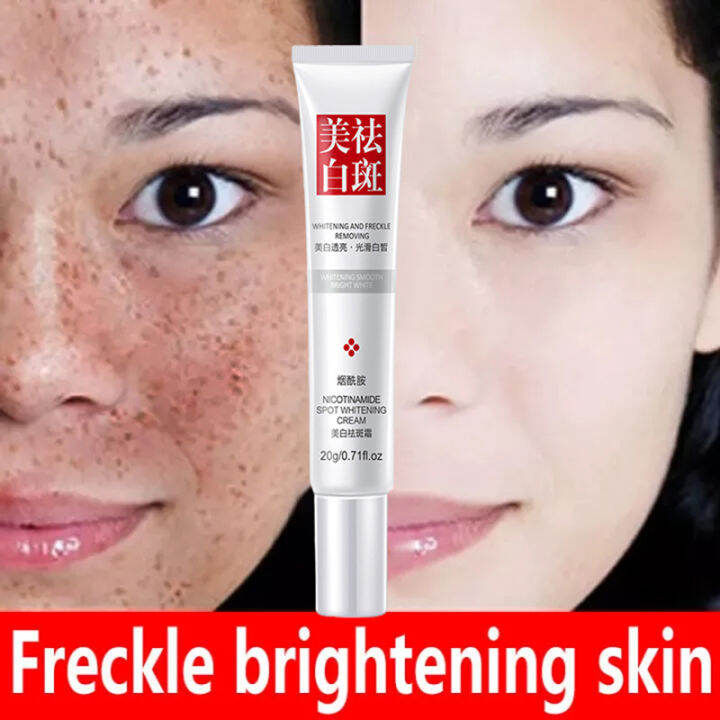 Face Whitening Effective Freckle Cream Remove Melasma Acne Dark Spot