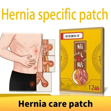 HPH Umbilical Navel Hernia Belt – HPH Hernia Support Products