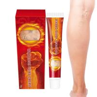 Varicose Vein Treatments Cream Effective Relieve Legs Dilated Vasculitis Phlebitis Natural Formula Ointment For well made