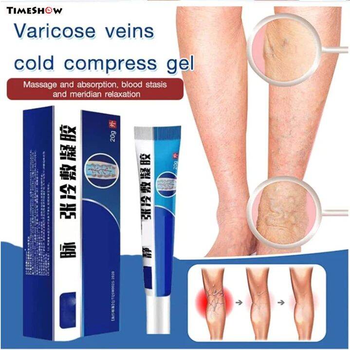 TimeShow 20g Vein Healing Ointment Leg Swelling Pain Relief Natural