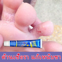 Sumifun ครีมลดกลิ่นเท้า ยาแก้เท้าเหม็น ครีมติดเชื้อรา กำจัดกลิ่นเท้า/คันเท้า/เท้าแห้งเป็นขุย/แผลพุพอง/ลอก/เท้าเน่า กำจัดเชื้อราแก้ปัญหาเท้าได้อย่างมีประสิทธิภาพ (ระงับกลิ่นเท้า ดับกลิ่นเท้า แก้เท้าเหม็น กำจัดเหน็บชา กลิ่นเท้า เท้าเหม็น）