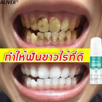 【ลดราคาครั้งใหญ่】ALIVER มูสแปรงฟันขาว 60ml ทำความสะอาดฟันเพื่อรักษาสุขภาพช่องปาก (น้ำยากัดหินปูน ยาสีฟันฟันขาว ทำให้ฟันขาว ยาสีฟันฟอกฟันขาว น้ำยาทำความสะอาดฟัน ฟอกฟันขาว น้ำยาขัดฟันขาว การฟอกสีฟัน น้ำยาฟอกฟันขาว สีฟันไวท์เทนนิ่ง สีฟันฟอกขาว)