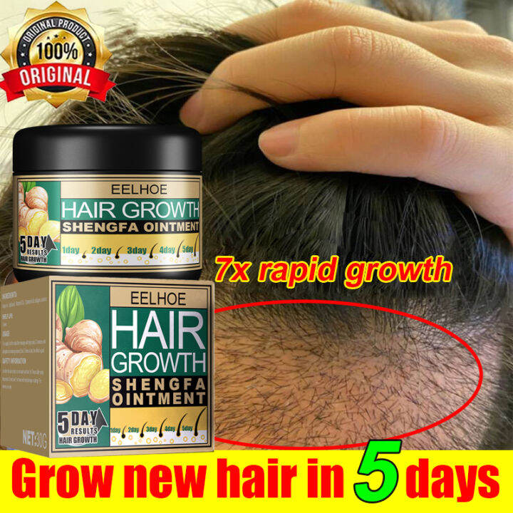 Eelhoe Ginger Hair Growth Care Ointment Hair Growth Essential Oil Anti