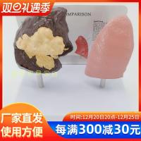 Pulmonary lung model structure mould smoking harm health smoking lung pathological lung respiratory anatomical model