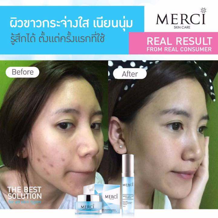 สินค้าแท้-100-ลดสิว-ลดผื่นได้ดี-merci-sleeping-maskii-30g-เมอร์ซี่-สลิปปิ้ง-มาส์ค-ทู-ครีมมาส์คหน้าขาวกระจ่างใส-ช่วยลดสิวผดผื่นบนใบหน้า