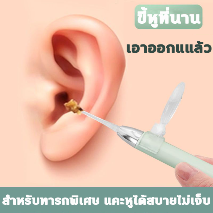 แว่นขยายความชัดสูง-8-เท่า-ที่แคะหูมีไฟ-ที่แคะหู-เครื่องดูดขี้หู-ที่แคะขี้หู-ที่แคะหูเด็ก-ไม้แคะหูมีไฟ-แหนบแคะหู-แหล่งกำเนิดแสง-led-แถมแว่น-ช่องหูมองเห็นได้ชัดเจน-ไม้แคะหู-แคะขี้หู-ตะขอแคะหู-ที่เเคะขี้