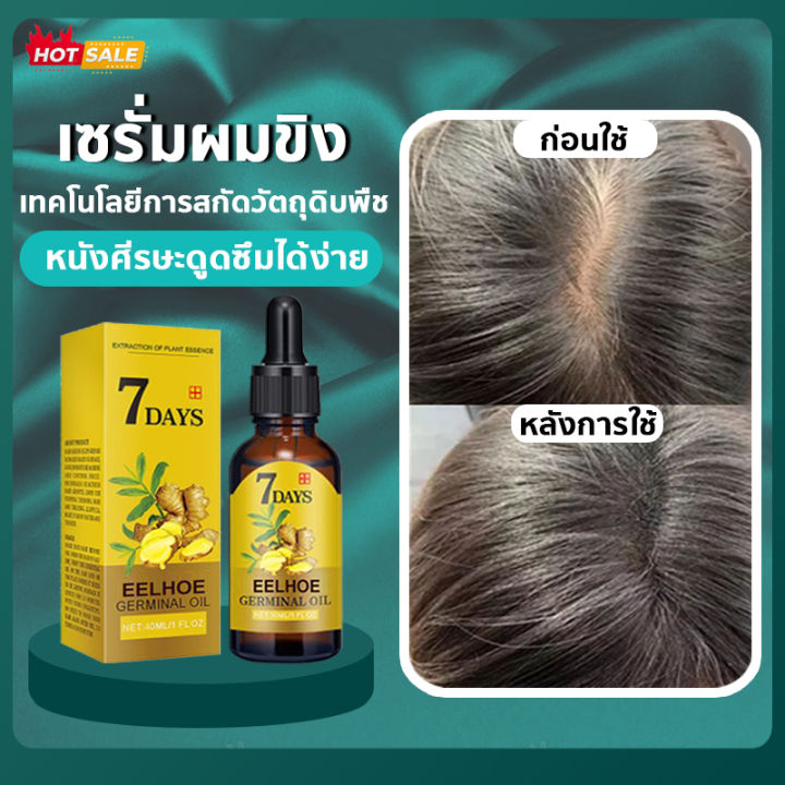 เซรั่มผมขิง40Ml สารสกัดจากขิง ซ่อมแซมผมเสีย น้ำยาปลูกผมป้องกันผมร่วง  แฮร์โทนิค เซรั่มบำรุงหนังศีรษะ เซรั่มบำรุงหนังศีรษะ เซรั่มบำรุงผม |  Lazada.Co.Th